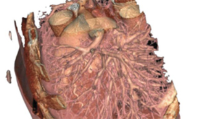 Arterial Structure