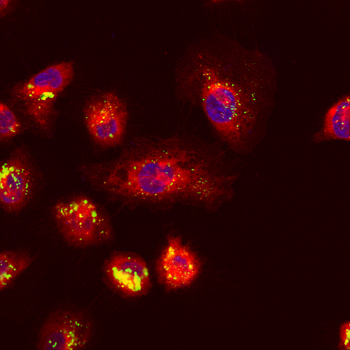 Malignant Cells Malignant Cells